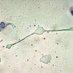 Macrophage